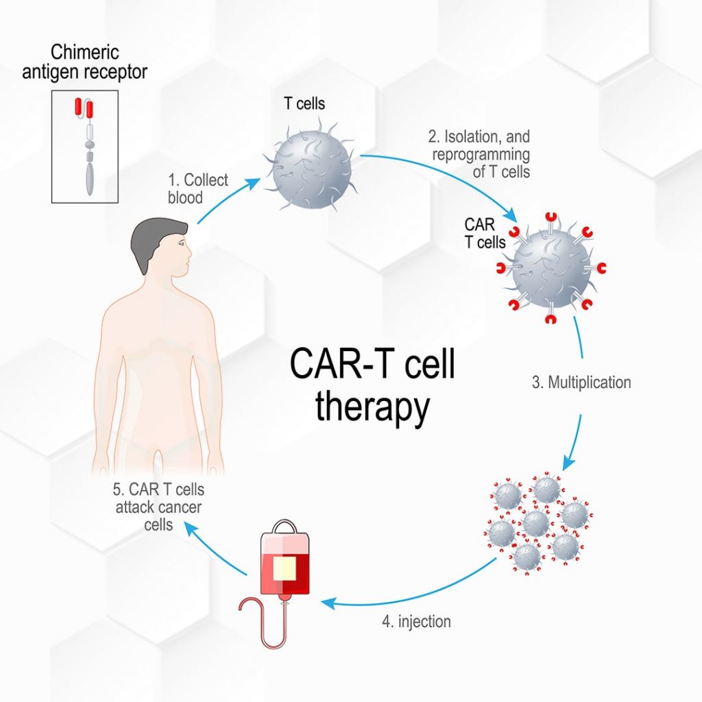 ALLpaQ-CAR-T-Cell-Therapy-Process